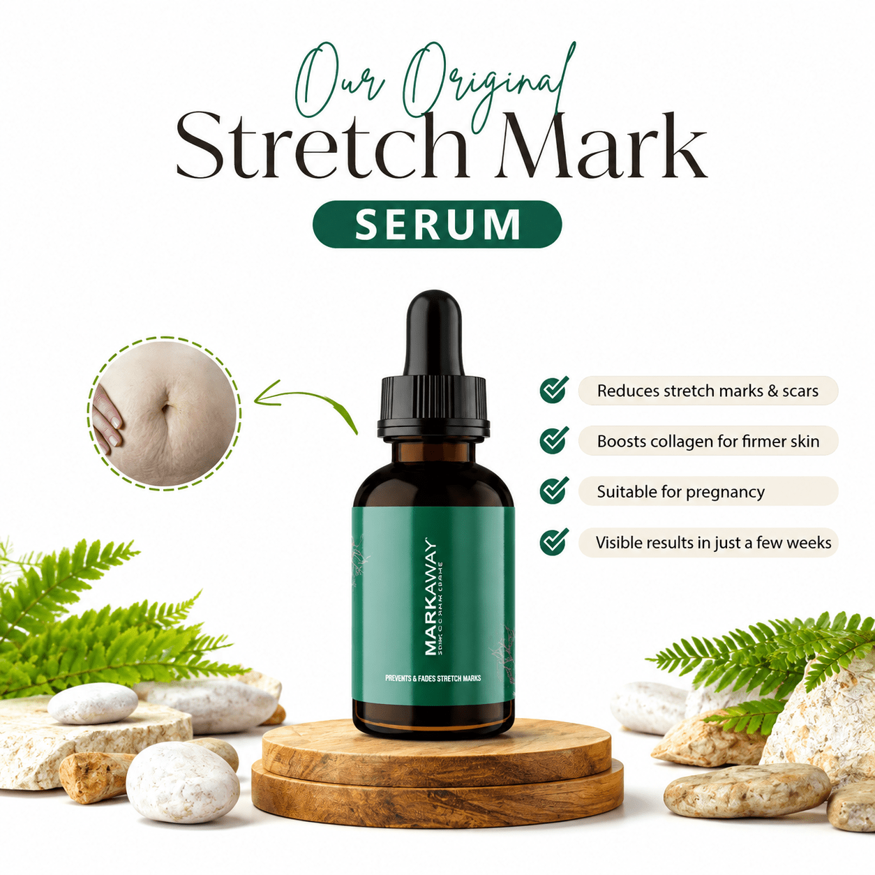 Anti-Aging Stretch Mark Serum for Pregnant Women